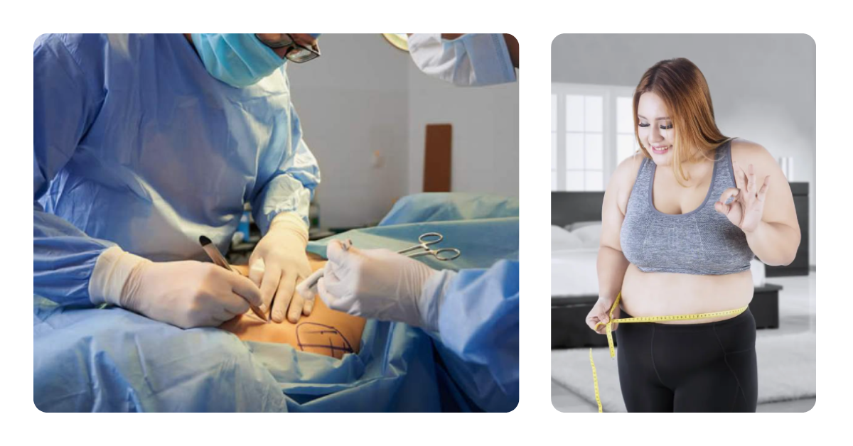 A Importância do Suporte Psicológico na Cirurgia Bariátrica